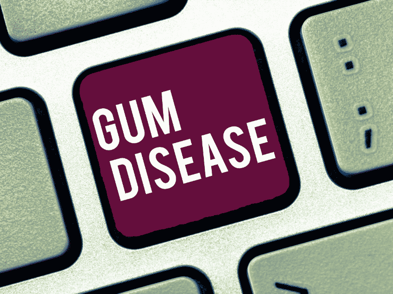 What is Gum Disease?